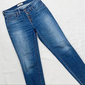 Madewell 9 Inch Skinny Button Fly Jeans